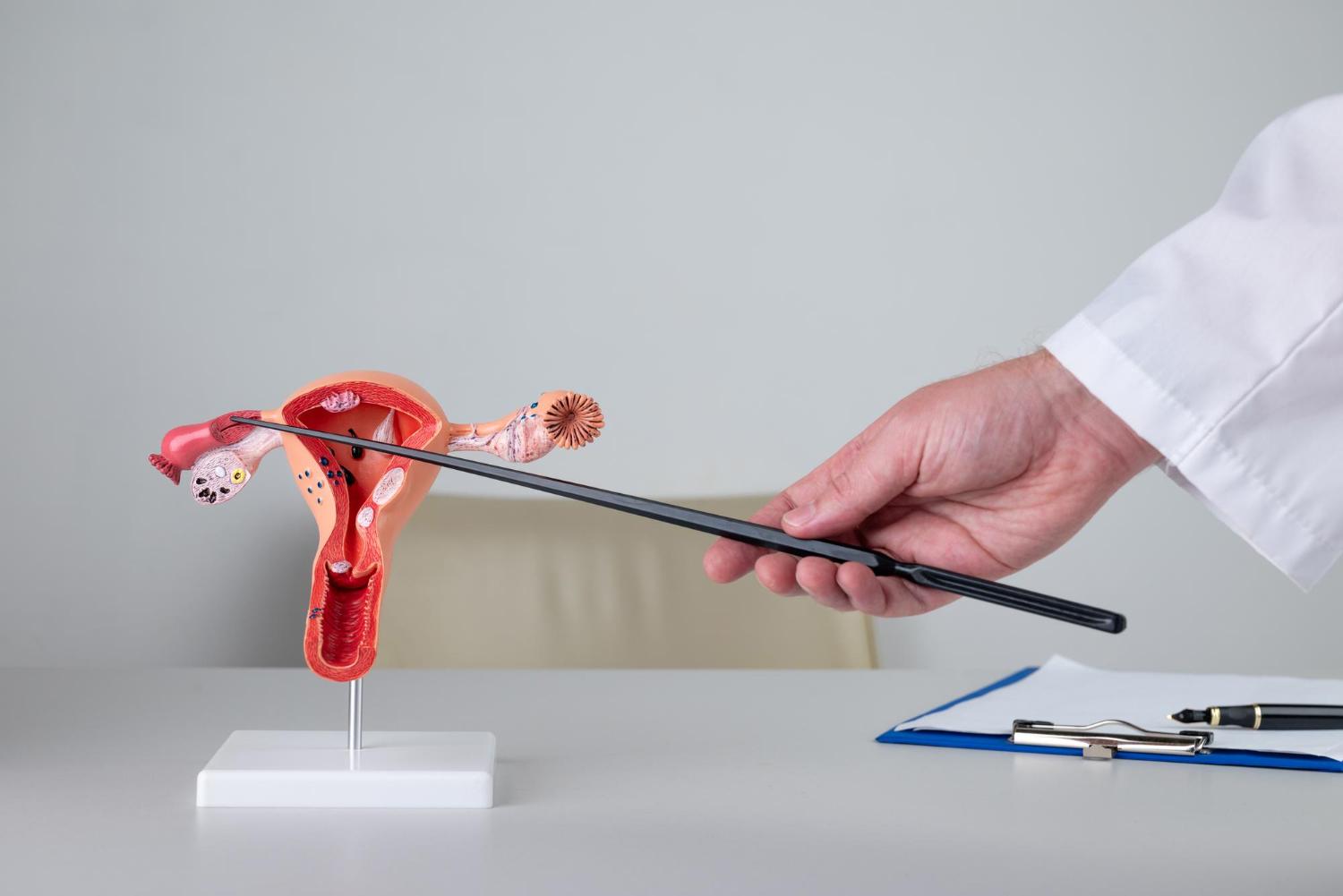 Endometrial Polip: Belirtileri, Teşhis Yöntemleri